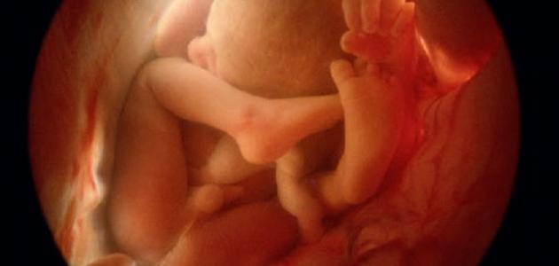 وضعية الجنين المقعدي في الولادة ومتي تتطلب إجراء العملية القيصرية؟