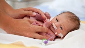 الولادة المبكرة تهديد لحياة الأطفال