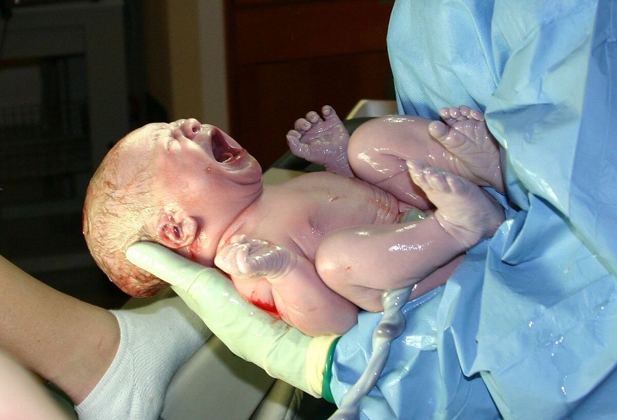 الولادة بدون ألم .. هل هو وهم تروج له المستشفيات أم حقيقة !