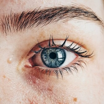 هل تعانين من جفاف الجلد حول عينيكِ ؟! إليكِ أهم العلاجات !  