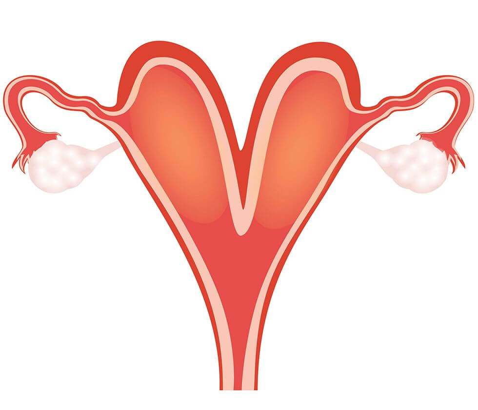 رحلة الأمل: كيف يحدث الحمل في حالة الرحم ذو القرنين؟