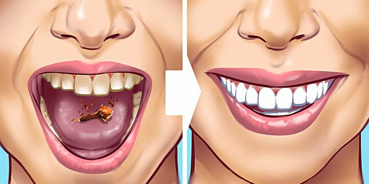 طرق سهلة وفعالة لإزالة بقع الجير من أسنانكِ!