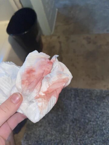 شكل إفرازات الحمل قبل الدورة بالصور