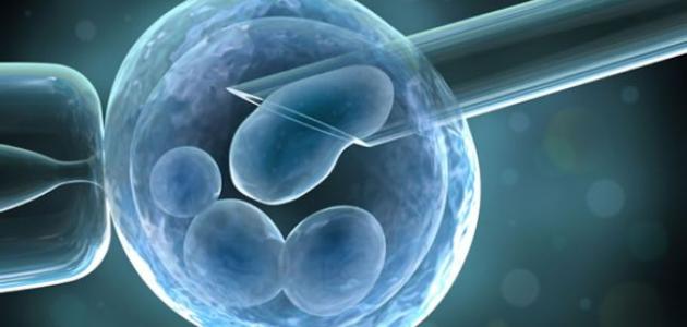 ما العلاقة بين الحقن المجهري والولادة المبكرة؟