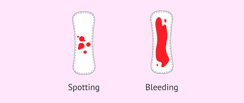 هل نزول الدم في الشهر التاسع من علامات الولادة