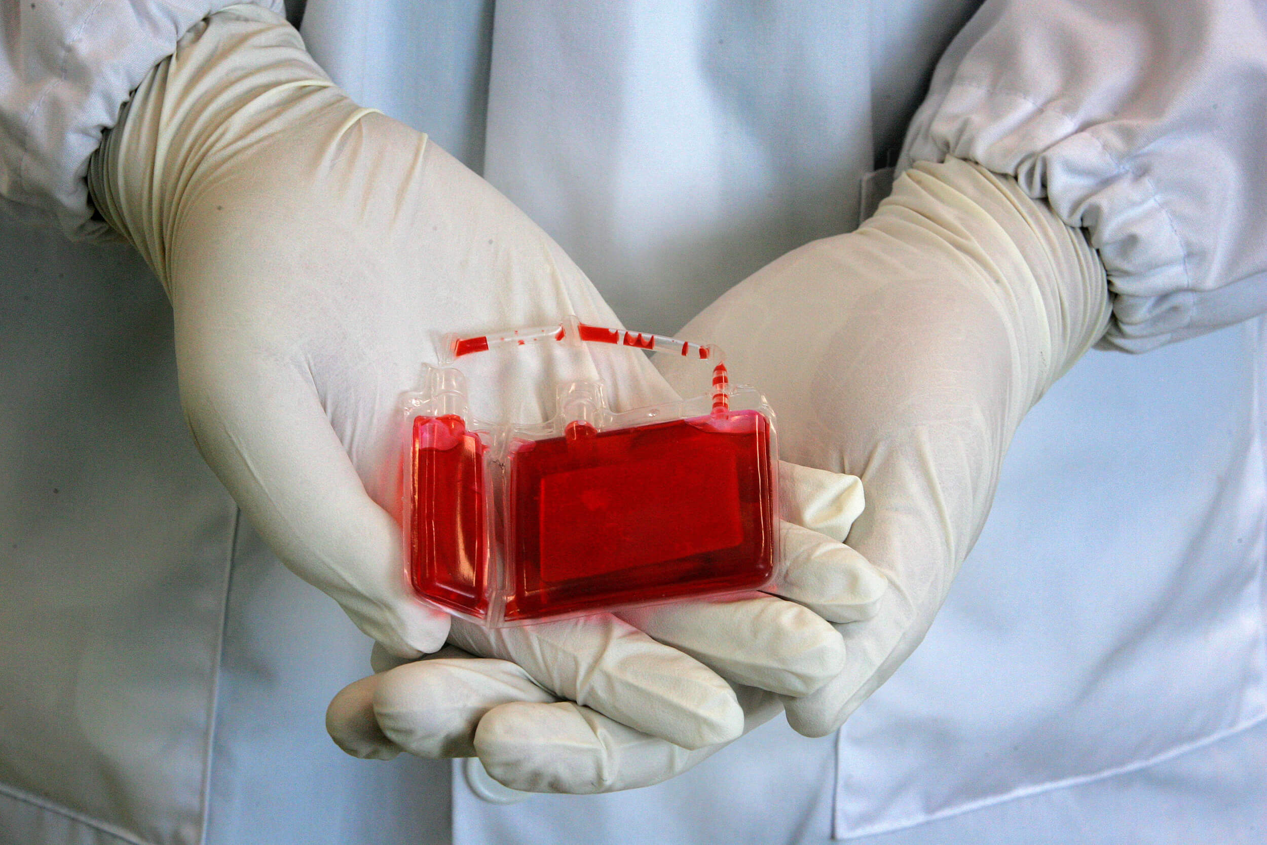 بنك دم للحبل السري ! بوسعك إنقاذ حياة ملايين البشر !