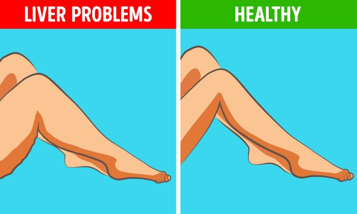 هل تعلمين أن مظهر ساقيكِ يمكن أن يخبراكِ الكثير عن صحتكِ؟! 