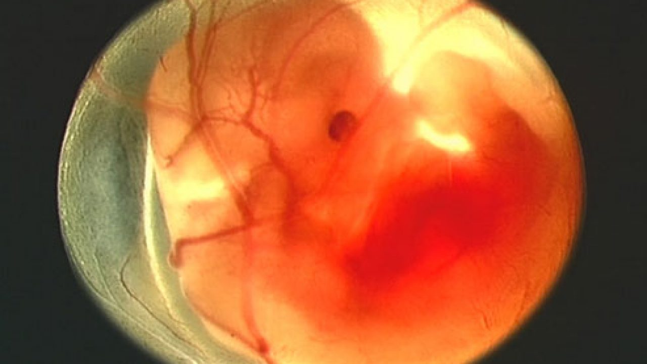 اكتشفي مراحل تطور جنينك من شكل دم الحمل بالصور