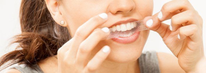 الأسنان الصفراء: أسباب حدوثها وكيفية تبييضها