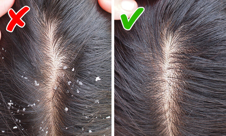 6 طرق لإعادة نمو الشعر بشكل طبيعي ومحاربة تساقط الشعر !     